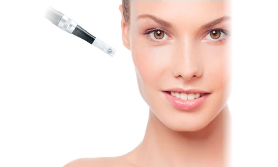 Microneedling (DERMAPEN)